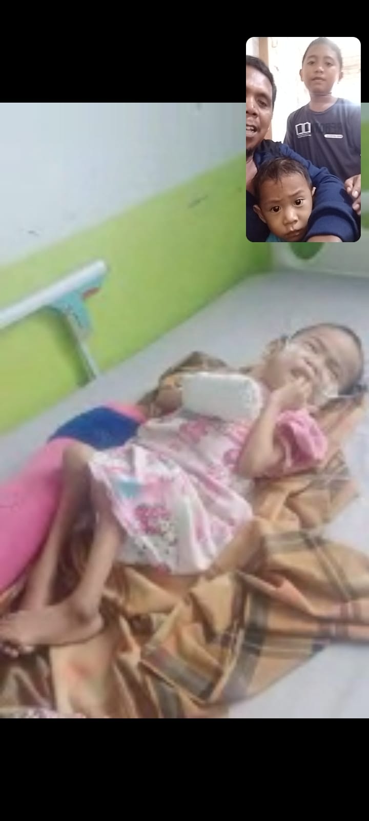 Warga Baras Nursafira Umur 5 Tahun Menyedap Penyakit Gizi Buruk Butuh Sangat Memperhatikan